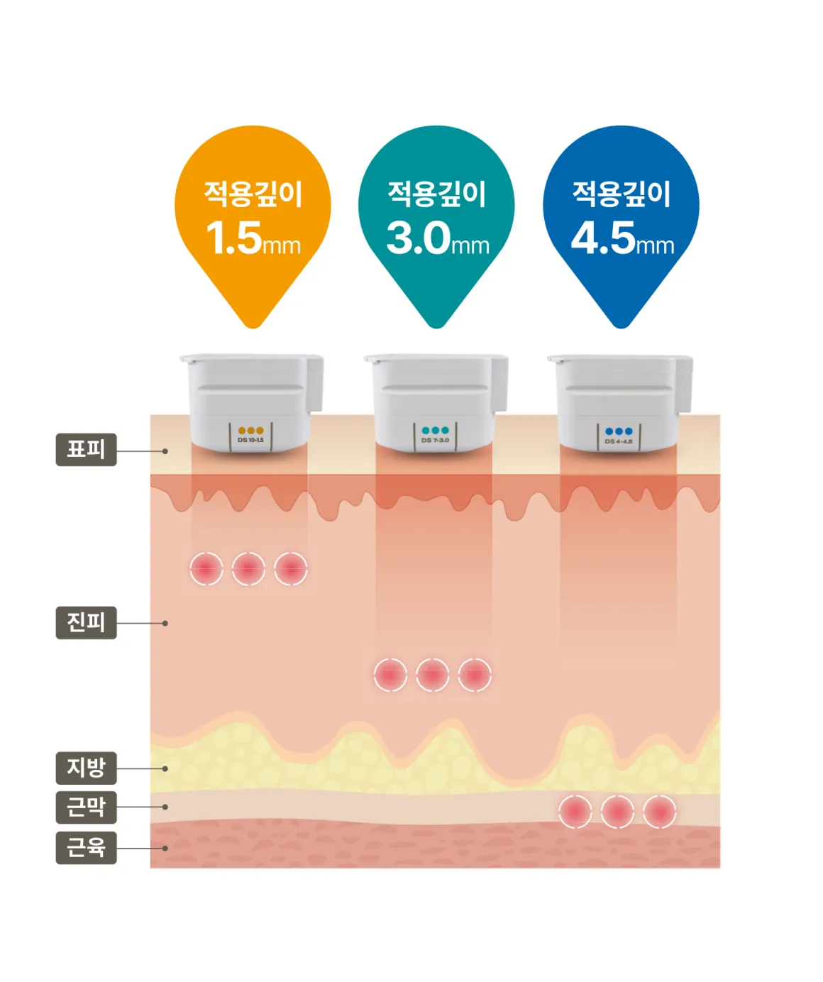 3 個按應用深度劃分的技巧圖