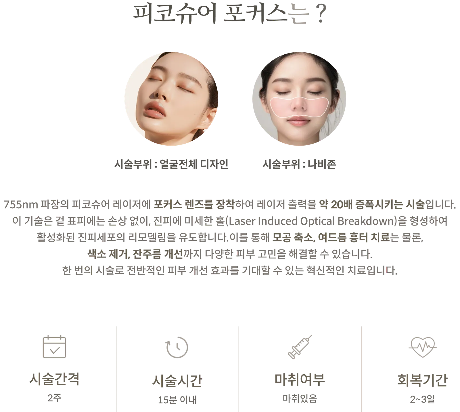 PicoSure Focus療程資訊面板：療程區域：全臉設計或蝴蝶區；使用配備聚焦透鏡的755nm雷射進行LIOB原理講解；療程間隔：2週；療程時間：15分鐘以內；需要麻醉；恢復期：2-3天