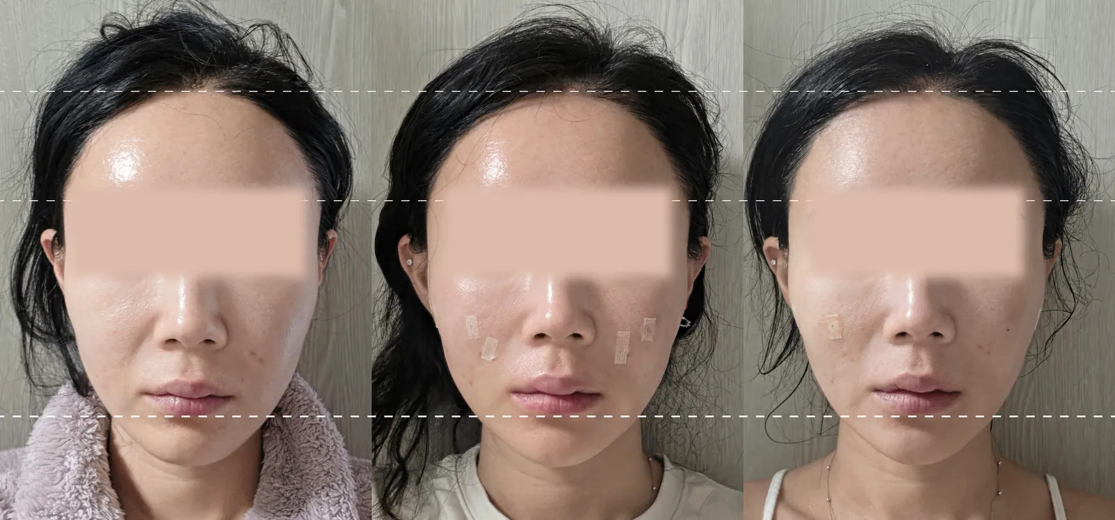 塑形前後對比照片